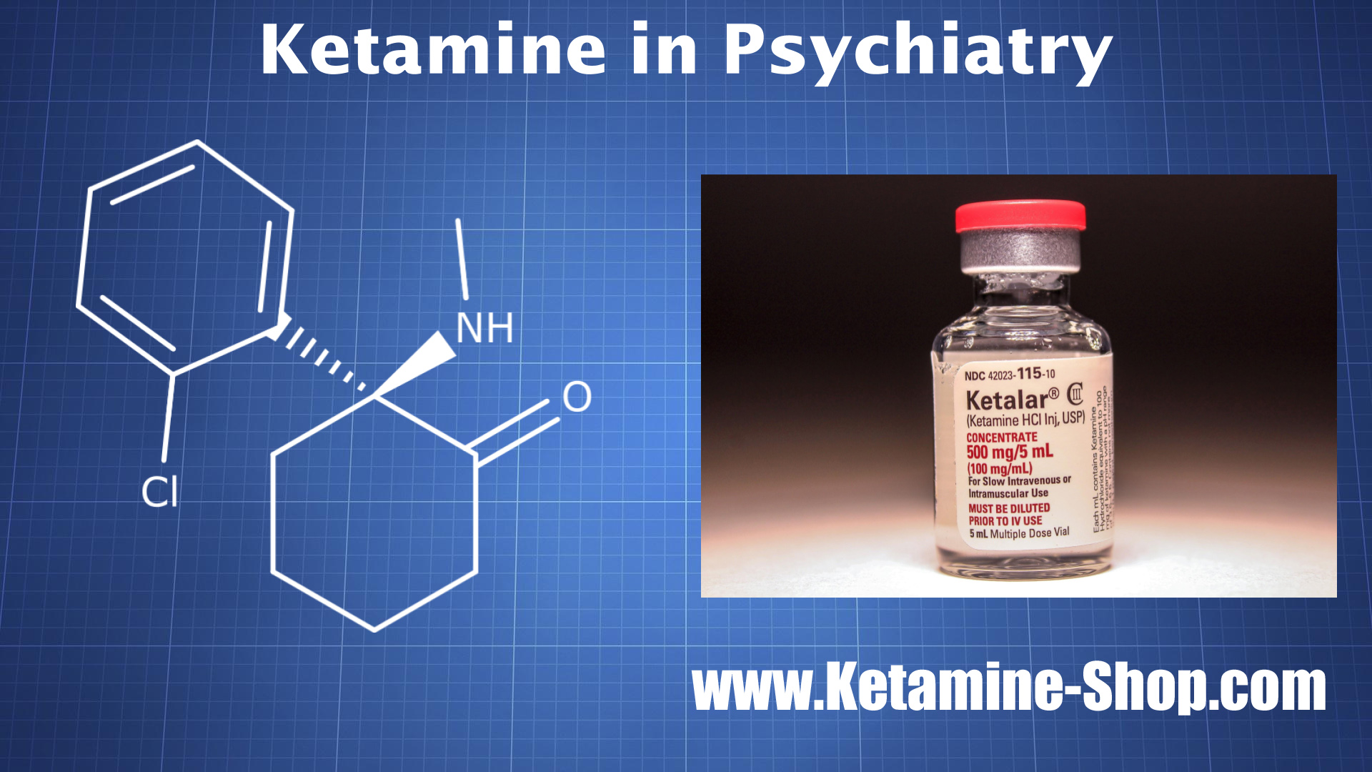 About - Can I Buy Ketamine U.S. (Hydrochloride Injections)